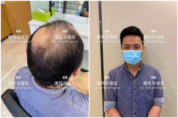 東莞什么地方有假發實體店 \