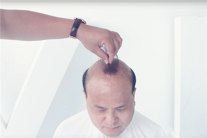 北京朝陽(yáng)假發(fā)專(zhuān)賣(mài)店哪里有 \