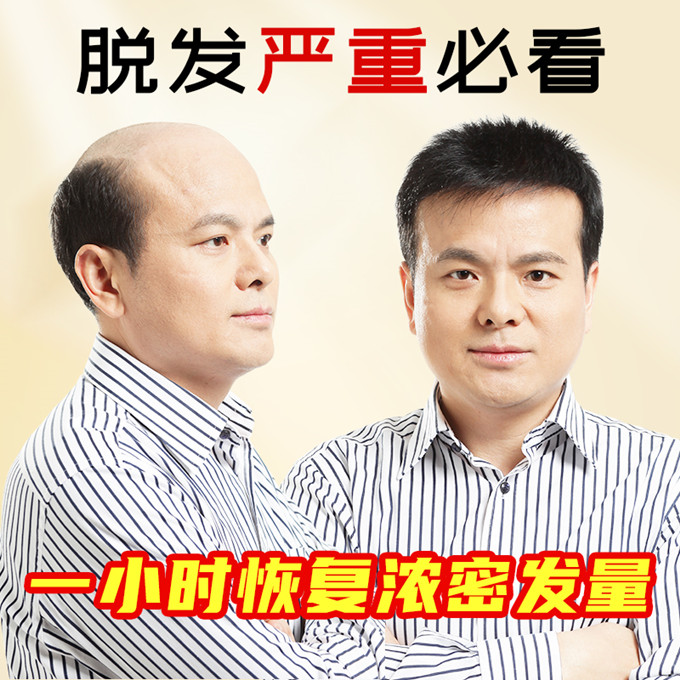 北京海淀私人訂制假發 \