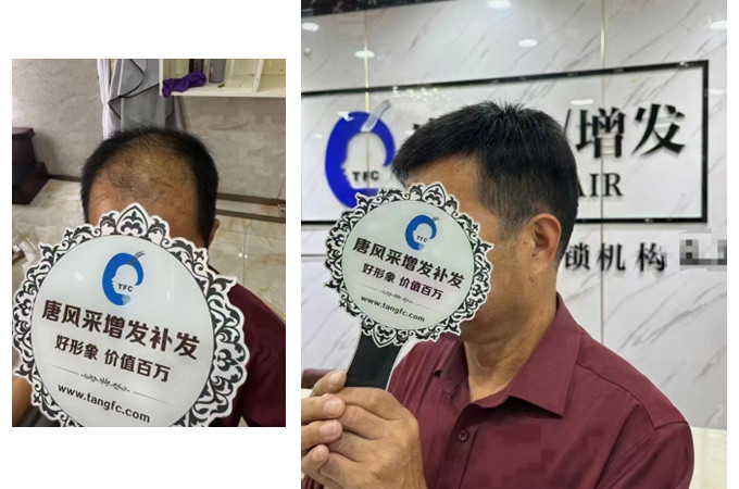 大連假發去哪里買比較好 \