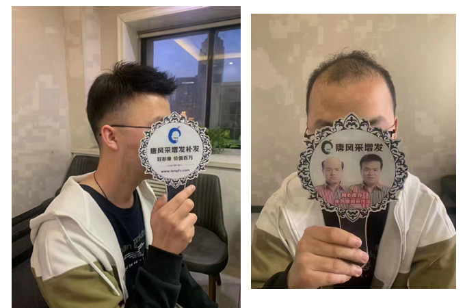 南昌哪有假發實體店 \
