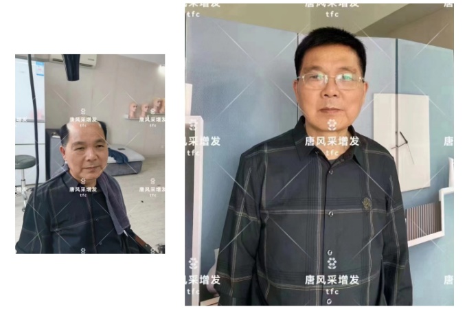 重慶有可以定假發的地方嗎 \