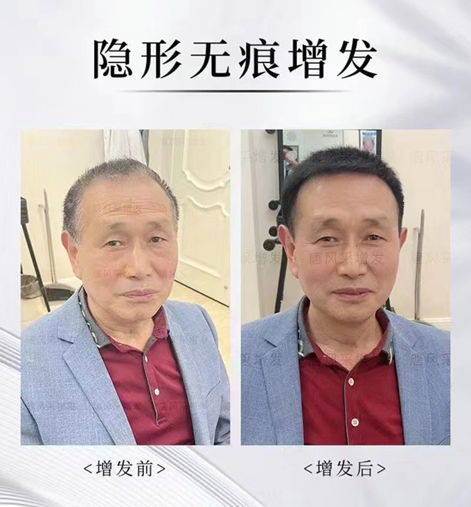 昆明假發實體店 \