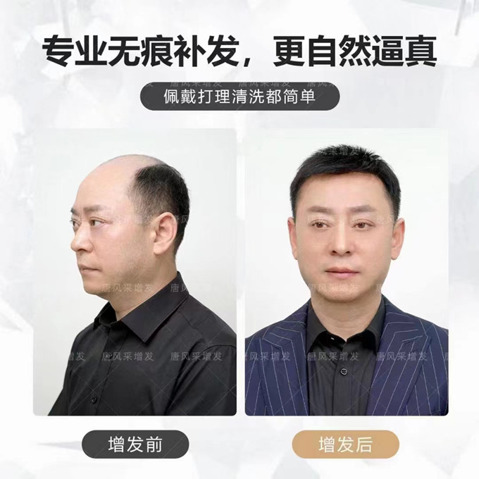 男士定制假發 \