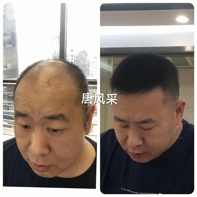 男士定制假發 \