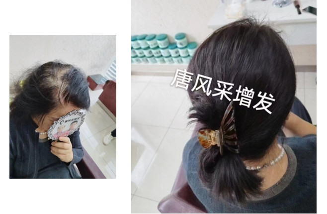 可定制假發 \