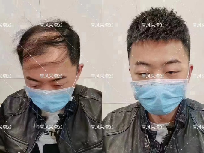 定制假發佩戴體驗 \