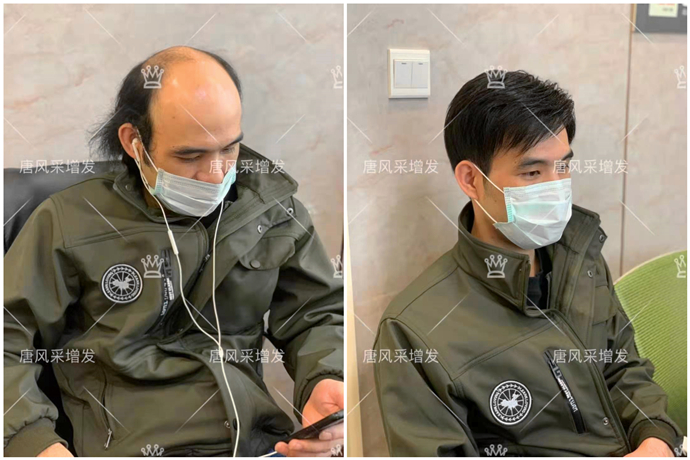 粘貼隱形假發片 \