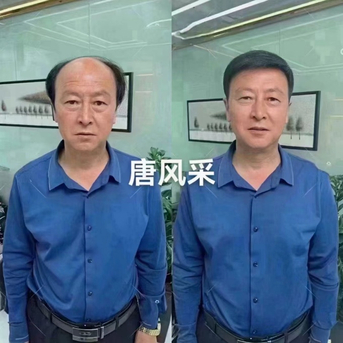 粘貼隱形假發片 \