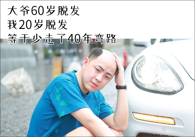 溫州隱形補發假發 \