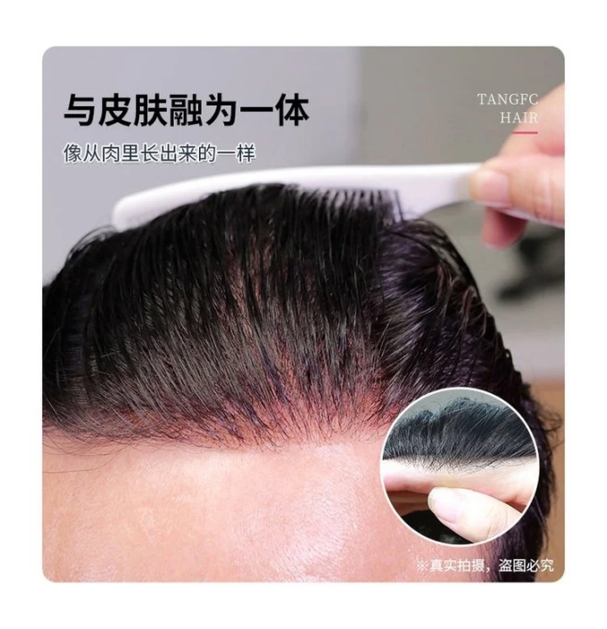 溫州隱形補發假發 \