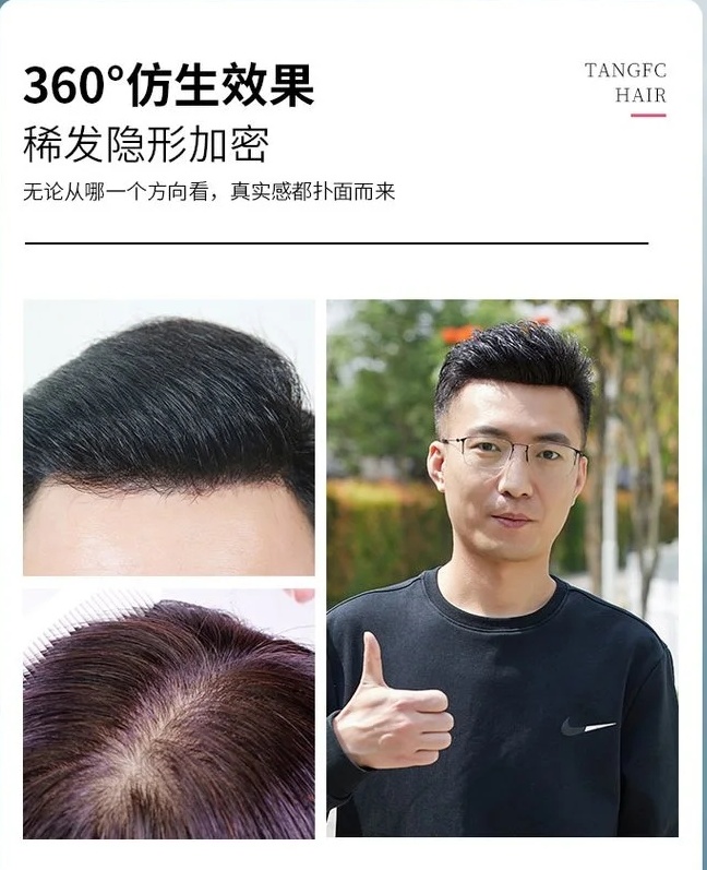 溫州隱形補發假發 \