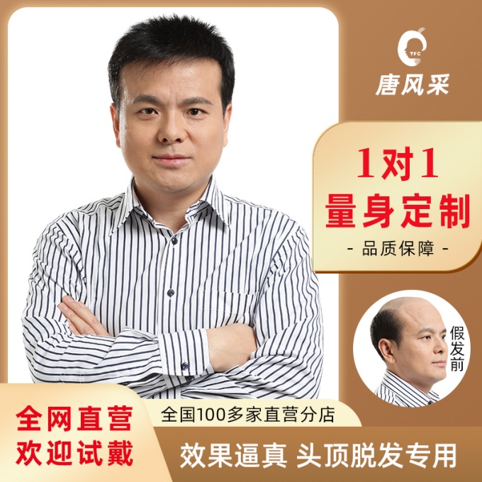 溫州隱形補發假發 \