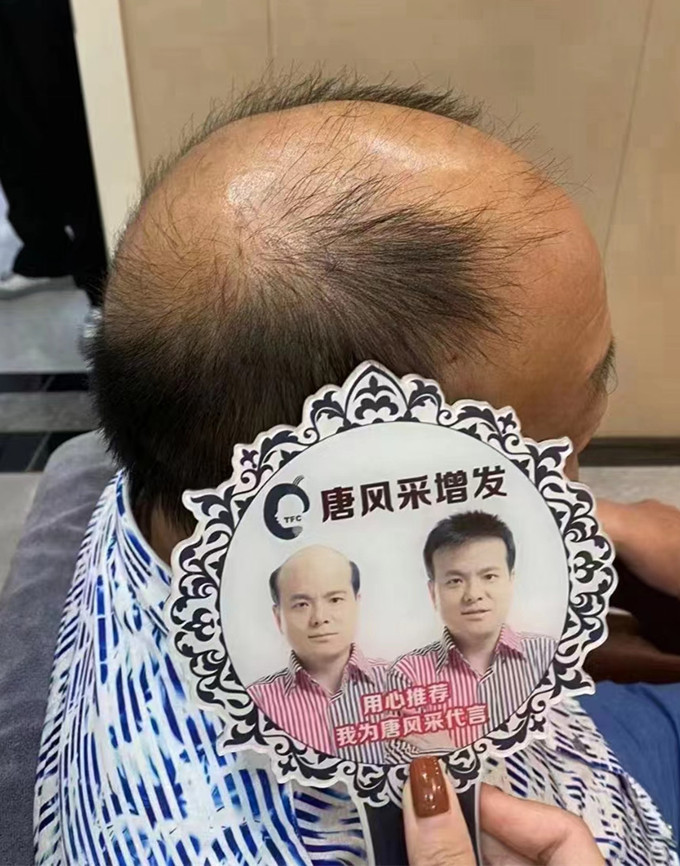 戴假發可以看出來嗎 \