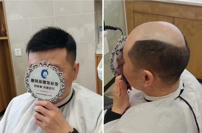 男補發假發 \