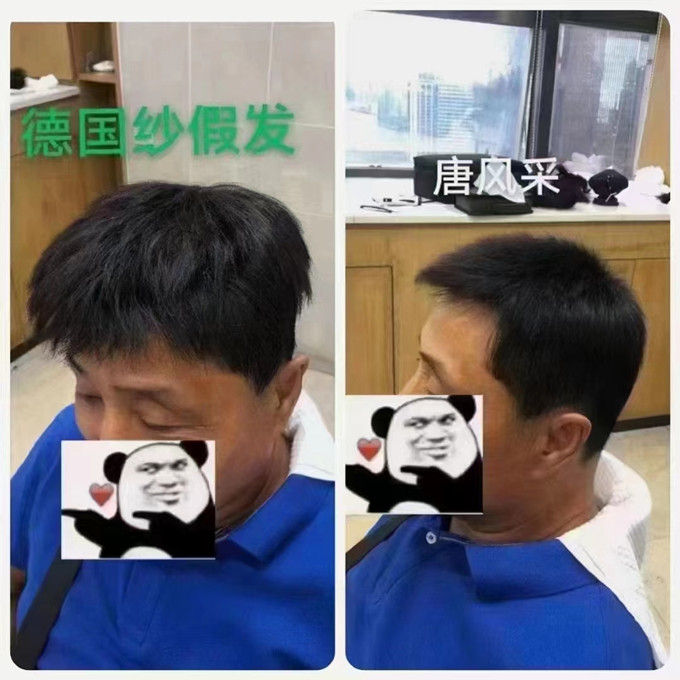 男補發假發 \