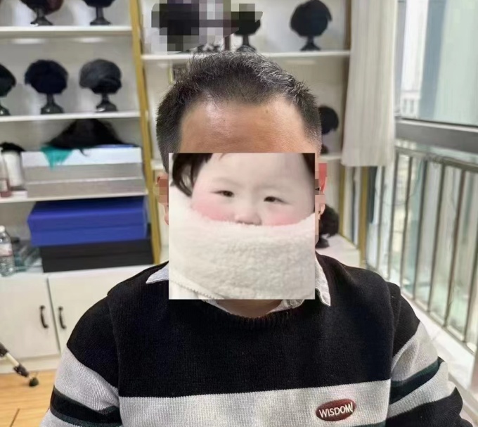 頭頂假發片 \