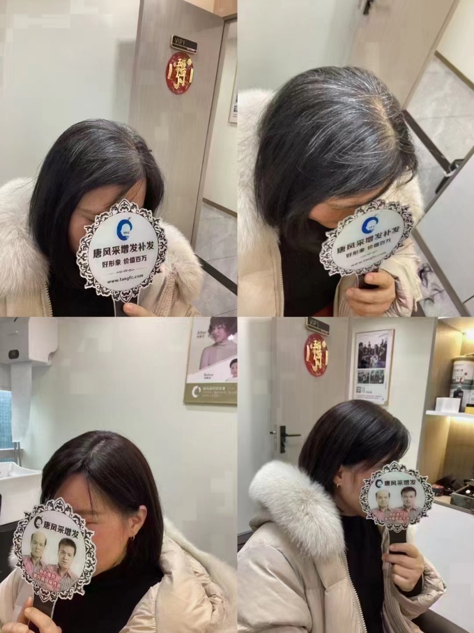 全真發定制假發 \