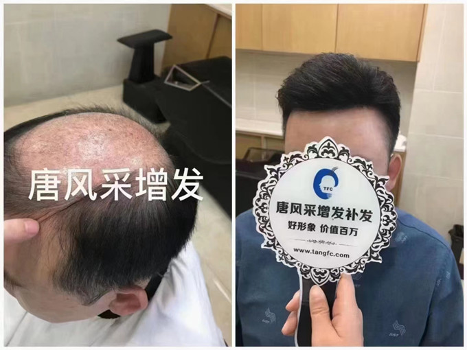 唐風采武漢假發(fā)實體店 \