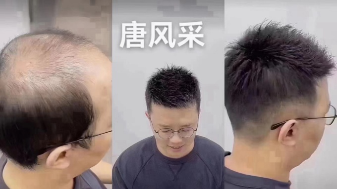 唐風采徐州補發假發中心 \