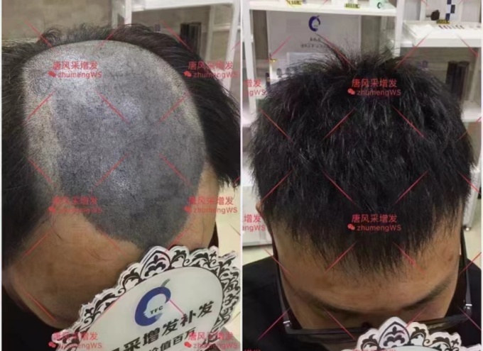 大叔戴假發 \