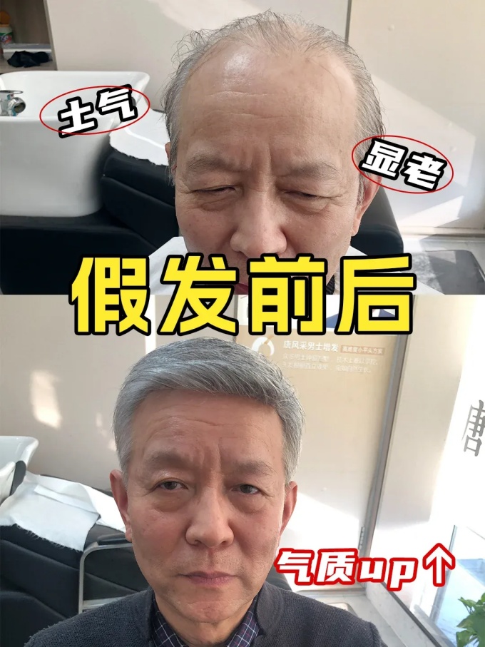 發量危機 \