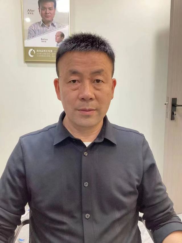 長沙假發定制哪家好 \