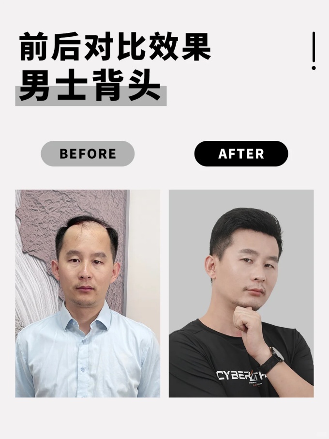 西寧假發哪家好 \