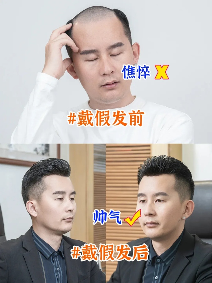 西寧假發哪家好 \